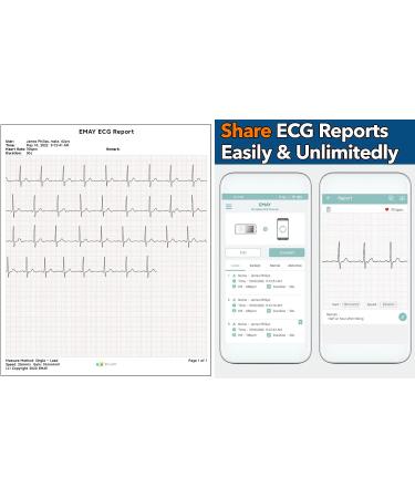 EMAY Portable ECG Monitor | Record ECG and Heart Rate Anytime Anywhere | Stand-Alone Device with LCD Screen and Storage | No Subscription Required - Buy Online on GoSupps.com