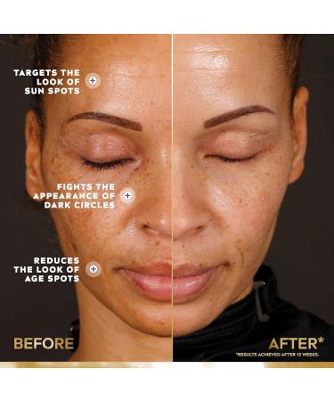 NIVEA LUMINOUS630 Dark Spot Solution Advanced Serum | Visibly reduces dark spots in just 2 weeks & Q10+ Firming Body Lotion | With 2 antioxidants : Q10 coenzyme + Vitamin C - Buy Online on GoSupps.com