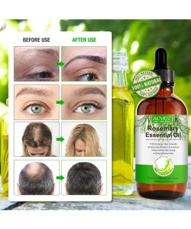 Premium Rosemary Oil for Hair Growth 120ml | Essential Oil for Thinning Damaged Hair - Includes Silicone Scalp Massager - Buy Online on GoSupps.com