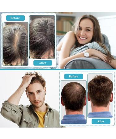Peigne de croissance des cheveux laser th rapie par lumi re rouge pour la croissance des cheveux traitement de la perte de cheveux au laser pour hommes et femmes traitement des cheveux clairsem s bleu - Buy Online on GoSupps.com