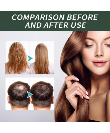Organic Batana Oil for Hair Growth | Prevents Hair Loss & Repairs Damaged Hair - 4.3 Oz - Buy Online on GoSupps.com
