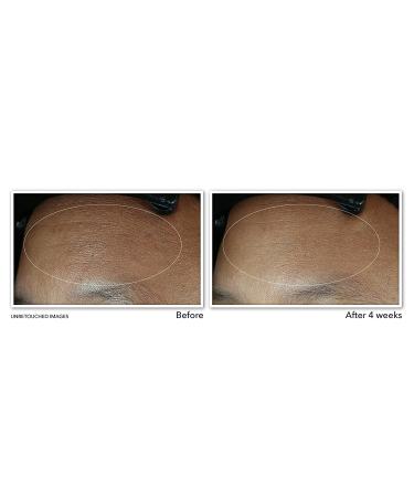 RoC Retinol Correxion Max Daily Hydration Crأ¨me 1.7 oz - Anti-Aging Moisturizer - Buy Online on GoSupps.com