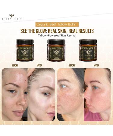 Organic Grass-Fed Beef Tallow Balm with Raw Honey - Moisturizing Cream for Soft Smooth Skin - Handmade All-Natural Moisturizer (4oz Unscented) Unscented 4 Fl Oz (Pack of 1) - Buy Online on GoSupps.com