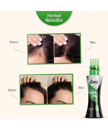 Buy New Improved Herbal Hair Oil with Wonder Cap (100 ml) - Enhance Hair Growth & Shine | International Shipping Available - Buy Online on GoSupps.com