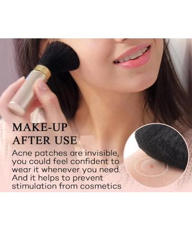 Acne Spot Patch - Hydrocolloid Blemish Treatment | Vegan Cruelty-Free & Advanced Adhesion - 36 Patches - Buy Online on GoSupps.com
