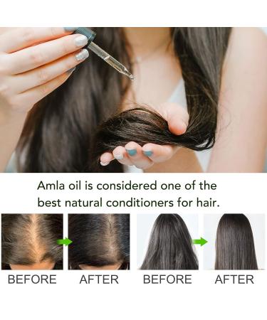 Alma Oil Hair - Stimulate Growth & Nourish Scalp | 60ml Aromatherapy & Massage Oil for Men & Women - Buy Online on GoSupps.com