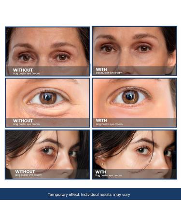 Bag Buster Eye Cream - Instant Reduction & Anti-Aging | Rapid Lift for Wrinkles Dark Circles & Fine Lines | Powdery Residue Free | 10ml - Buy Online on GoSupps.com