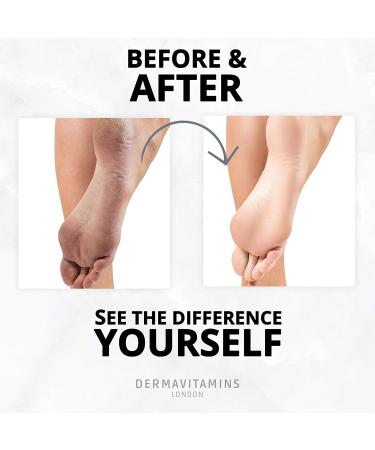 Dermavitamins Advanced Exfoliating Foot Mask Bag - Repair Dry Feet | Effective Foot Care Solution - Buy Online on GoSupps.com
