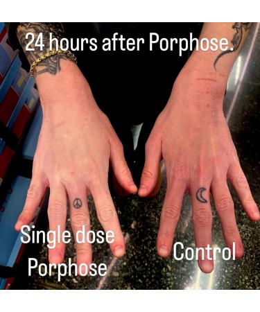 Porphose Skin Shielding Mist: Hydrating Antioxidant for Dry and Sensitive Skin. Hypoallergenic Fragrance Free Dermatologist and Pediatrician Tested NATIONAL ECZEMA ASSOCIATION SEAL OF ACCEPTANCE - Buy Online on GoSupps.com