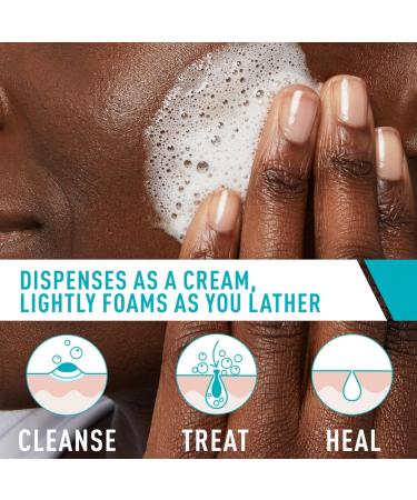 CeraVe Acne Foaming Cream Cleanser with 4% Benzoyl Peroxide, Hyaluronic Acid & Niacinamide - 5 Oz | Fragrance-Free, Non-Comedogenic Acne Treatment Face Wash - Buy Online on GoSupps.com