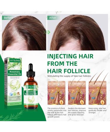 100% Natural Rosemary Oil for Hair Growth | 60ml Organic Rosemary Oil for Scalp Aromatherapy & Massage - Buy Online on GoSupps.com