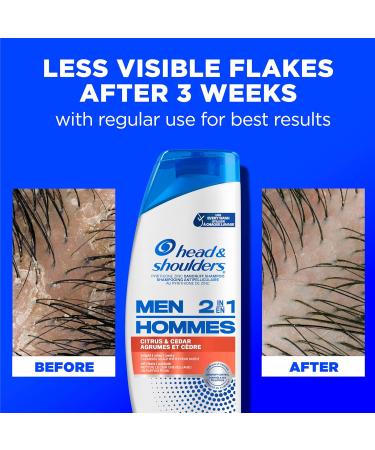 Head and Shoulders Mens 2 in 1 Dandruff Shampoo and Conditioner Anti-Dandruff Treatment Citrus & Cedar for Daily Use Paraben Free 370 mL (Packaging May Vary) Citrus + Cedar - Buy Online on GoSupps.com