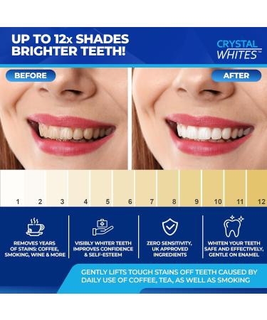 Teeth Whitening Strips 50 Pack - Sensitivity Free Strips | Enamel Safe | 25 Sessions | Mouth Opener + Teeth Wipes Included | Ultimate Stain Remover Dental Kit - Buy Online on GoSupps.com