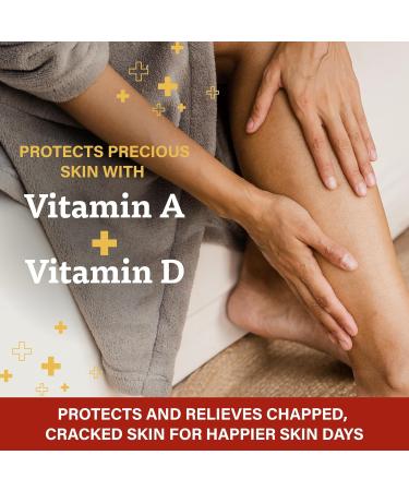 A+D First Aid Multipurpose Healing Ointment - Moisturizing Skin Protectant for Dry Cracked Heels Elbows Hands and Lips - Protects Minor Cuts Burns & Scrapes 4 oz Tube 4 Ounce (Pack of 1) - Buy Online on GoSupps.com