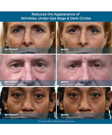 Plexaderm Eye Serum Pods - Instant Anti-Aging for Bags, Dark Circles & Wrinkles - Buy Online on GoSupps.com