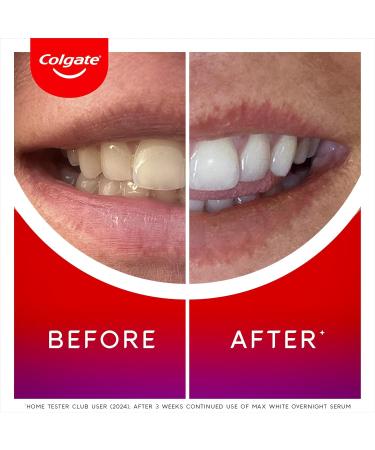 Colgate Max White Overnight Teeth Whitening Serum home teeth whitening pen reverses 15 years of stains new and improved applicator - 0.084 Oz - Buy Online on GoSupps.com