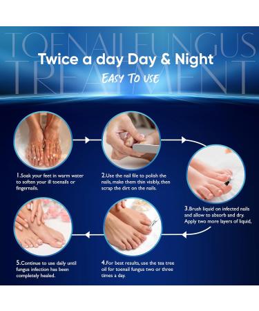 Extra Strength Toenail Fungus Treatment 30ML - Fast Relief for Men & Women | Nail Fungus Cure - Buy Online on GoSupps.com