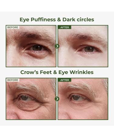 ABERA Turmeric Face Cleanser & Eye Roller Set Curcumin Facial Wash for Acne & Brightening + Cooling Eye Roller Serum for Dark Circles & Puffiness Relief - Buy Online on GoSupps.com