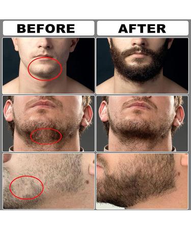 Beard Growth Kit 4 in 1 Men's Grooming Set with Roller, Serum, Balm | Birthday Gifts for Dad, Boyfriend - Buy Online on GoSupps.com