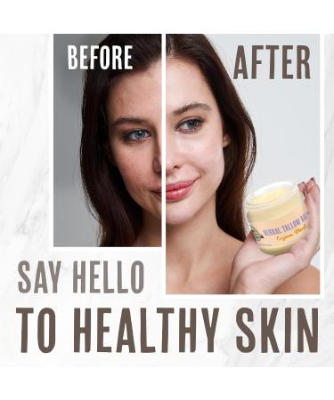 Buffalo Gal Grassfed Beauty - Herbal Tallow and Honey Balm for Eczema Dry Rendered Therapeutic Grade Lab Tested Tallow 100% Grassfed Superior Tallow Moisturizer for Face and Body Organic 2 oz - Buy Online on GoSupps.com