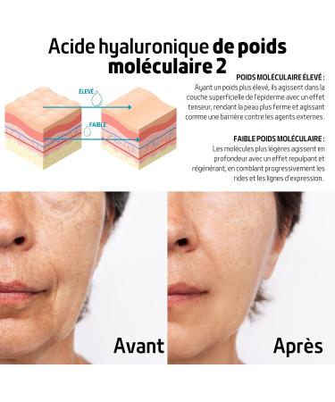 Face Cream 85% Snail Slime Hyaluronic Acid Vitamin E Shea Butter Aloe Vera - Powerful Anti-Wrinkle Moisturizing Anti-Dark Circles - Men & Women - Day & Night - 100ml - FITOATTIVI - Buy Online on GoSupps.com