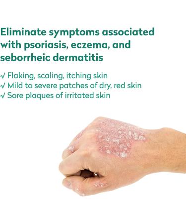 Dr. Blaine's REVITADERM Psoriasis Formula - Coal Tar Tea Tree Oil Lavender Cream for Dry Skin Relief - 4 fl. oz - Buy Online on GoSupps.com