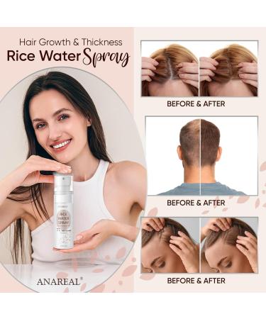 Rice Water Hair Growth Serum | Nourishing Rice Water Spray for Women | 60ml Hair Treatment - Buy Online on GoSupps.com