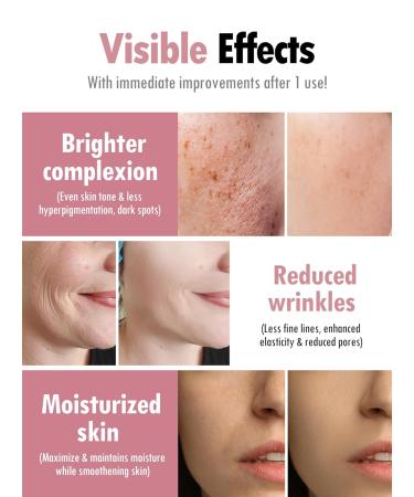 KAHI Wrinkle Bounce Skin Fit Blending Essence | Hydrating Daily Face Moisturizer for Dry & Combination Skin | Korean Skincare for Men & Women 1.01 fl oz - Buy Online on GoSupps.com