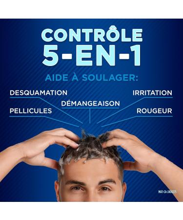 Selsun Blue Itchy Dry Scalp Anti-Dandruff Shampoo 300 mL Clean Fresh Scent For Itchy Dry Flaky Scaly Scalp Associated with Dandruff & Seborrheic Dermatitis - Buy Online on GoSupps.com