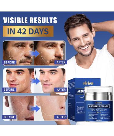 8-in-1 Face Cream for Men mens face moisturizer with Alpha Arbutin Retinol Collagen and Hyaluronic Acid Anti-Aging Face Cream for Men Eye Bags Treatment & Wrinkle Cream 2.03oz 2.03 Fl Oz (Pack of 1) - Buy Online on GoSupps.com