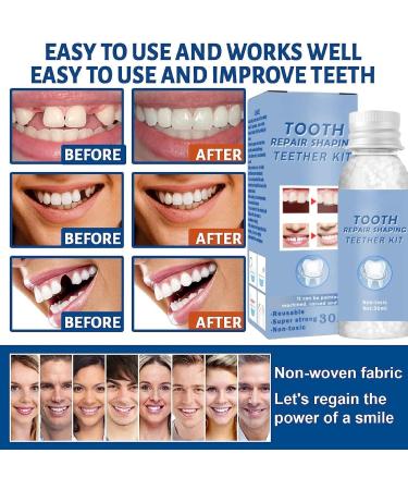 Temporary Tooth Filling Repair Kit - Moldable False Teeth Replacement | Tooth Repair Granules for Quick Fix | Fake Teeth Repair Beads - Buy Online on GoSupps.com