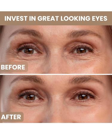 M.D. Blend Plant Stem Cell Eye Serum Complex | Aloe Vera Vitamin C | Hydrating Eye Treatment | Airless Pump - 15ml - Buy Online on GoSupps.com