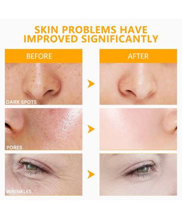 MAVENI High Concentration Snail Mucin Plumping Serum 100ml 3.38 fl.oz Hydrating Serum with Snail Reduce Wrinkles and Fine Lines Smooth Facial Skin - Buy Online on GoSupps.com