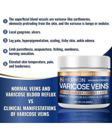 Hermon Varicose Veins Cream - Natural Treatment for Pain Relief and Soothing Leg Varicose & Spider Veins - 2 Oz - Buy Online on GoSupps.com