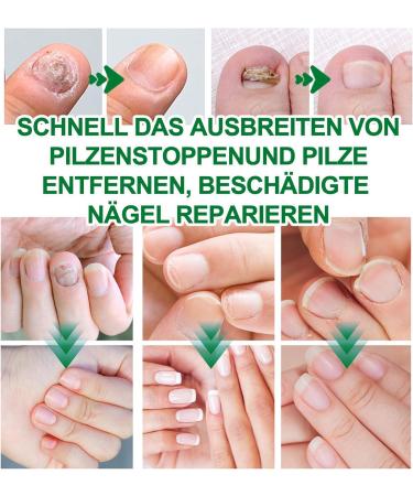 MrCuvaryas Ginger Nail Care Oil Nail care oil Nail care serum for brittle discolored and broken nails ginger cuticle care oil for nails nail care oil nail hard nail care for - Buy Online on GoSupps.com