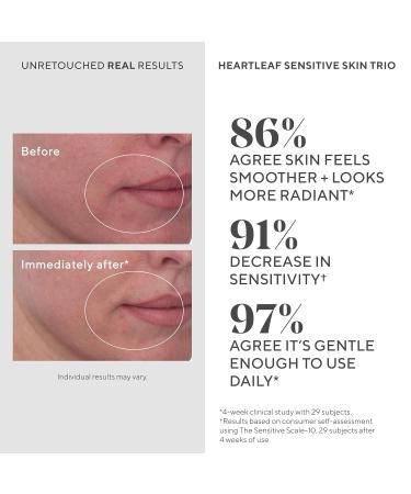 Murad Heartleaf Soothing Cleanser Gentle Face Wash with Fermented Heartleaf Beta-Glucan Ceramides and Microalgae to Reduce Redness & Calm Sensitive and Eczema-Prone Skin 5 Fl Oz - Buy Online on GoSupps.com