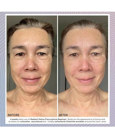 Droplette 2 Micro-Infuser Skin Care Tool & Radiant Refill Capsules - Hydration Starter Set with Collagen Retinol Glycolic Acid for Glowing Skin - Buy Online on GoSupps.com