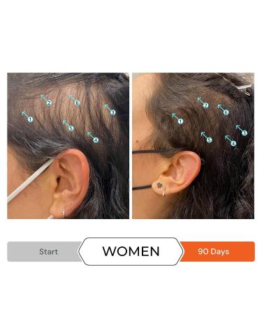 Revita Shampoo + Spectral.DNC-N Serum Bundle for Hair Thinning - Fuller, Thicker Hair | DS Laboratories (7 fl oz) - Men & Women - Buy Online on GoSupps.com