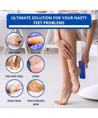 Love Natural Pumice Stone for Feet - 2-in-1 Exfoliating Scrubber for Dead Skin & Callus Removal - Professional Foot Care Rock (Blue - Buy Online on GoSupps.com
