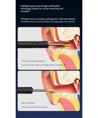 3-Piece Ear Wax Removal Tool Kit - Ear Cleaner in Black & White - Buy Online on GoSupps.com