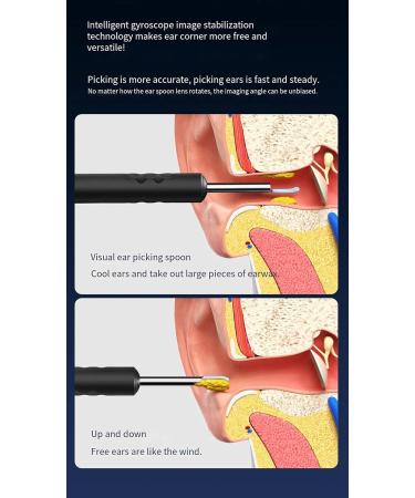 Ear Wax Removal Tool Ear Cleaner with 3 Ear Cleaning Kits Black White Black - Buy Online on GoSupps.com