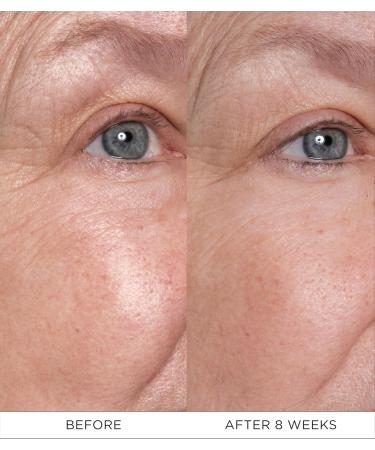 Noble Panacea The Eye Lift Concentrate 12 Doses Luxury Skincare Lifting and Firming Anti Aging Eye Cream for Dark Circles and Crows Feet with Retinal & Peptides - Buy Online on GoSupps.com