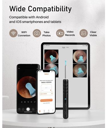 Bebird Pro Ear Wax Removal Tool with 1440P HD Camera and 6 LED Lights | Free Deep Cleaning Blackhead Remover | FDA Approved Ear Cleaner for Smaller Ears | iOS Android Compatible - Buy Online on GoSupps.com
