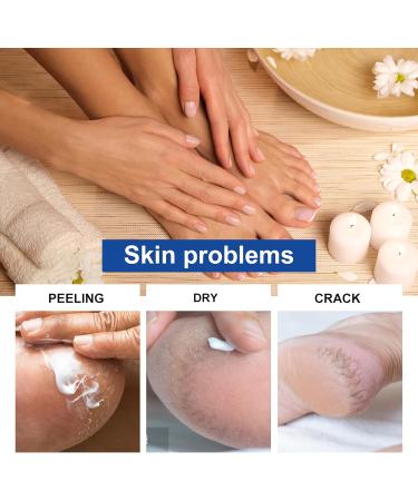  MrCuvaryas Urea Cream 60% + Moisturizing and Anti-Cracking Cream - Repairing Cream for Feet and Hands - Foot Cream for Cracked Heels and Dry Skin - Maximum Strength for Foot Care - Buy Online on GoSupps.com