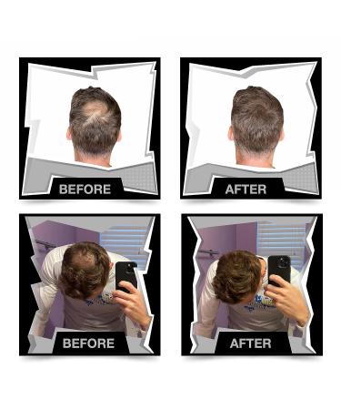 No More Bald Spot Black Hair Building Fibers - Hair Fillers Powder for Thinning Hair Men & Women - Bald Spot Cover Up & Scalp Concealer Powder - Buy Online on GoSupps.com