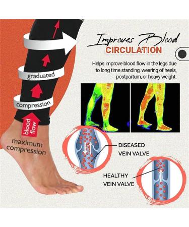 Royalaura Medical Grade Compression Stockings - Varicose Vein Relief Calf Sleeves for Men & Women (M Yellow) - Footless Compression Leggings - Buy Online on GoSupps.com