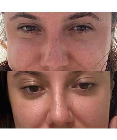 True Botanicals Organic Vitamin C Booster Powder - Clean Non-Toxic Skincare (.49 oz | 14 g) - Buy Online on GoSupps.com