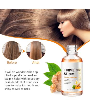 Turmeric Dark Spot Corrector Serum for Acne, Hyperpigmentation, Smooth Skin - 2PCS(60ml) - 1 Fl Oz - Buy Online on GoSupps.com
