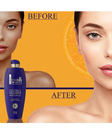 Fair and White Exclusive Skin Lightening Lotion 17 Fl oz - Dark Spots Cream for Uneven Skin Tone - Buy Online on GoSupps.com