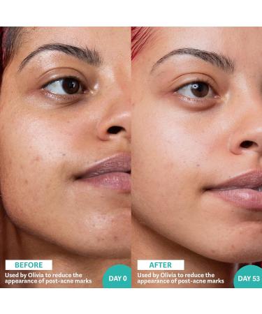 Selfless by Hyram Retinol and Rainbow Algae Repair Serum to Gently Target Post-Breakout Marks and Hyperpigmentation 30ml White - Buy Online on GoSupps.com